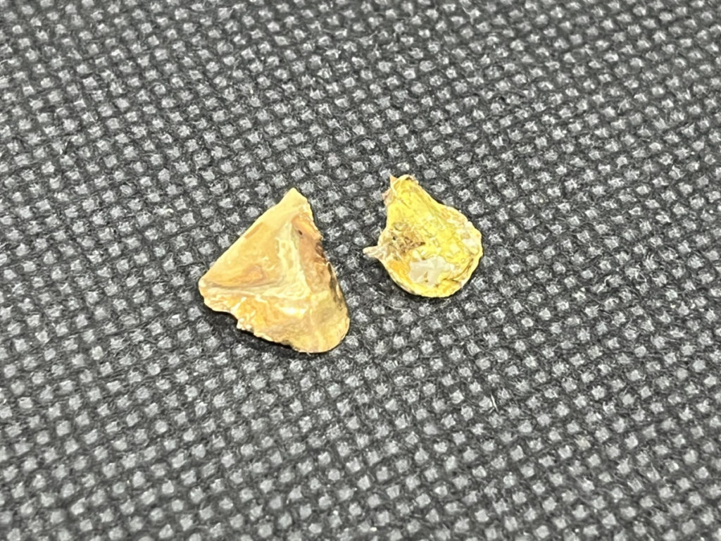 K18　金歯　1.0ｇ